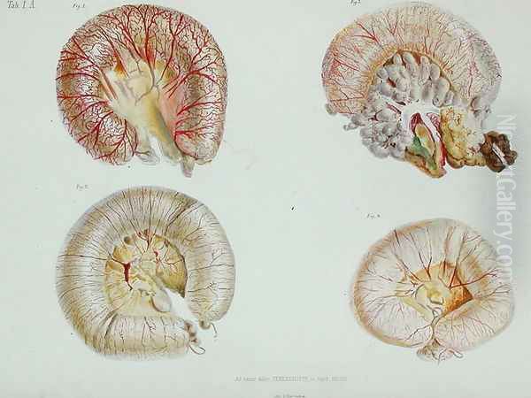 The external surface of the intestines infected with cholera, from 'Anatomie Pathologique du Cholera Morbus', by Nikolai Ivanovich Pirogov 1810-81 published in St. Petersburg, 1849 - view 1