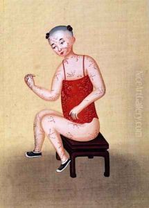 Child with smallpox (2)