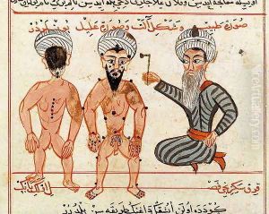 Ms Sup Turc 693 fol.46v Cauterisation of leprosy lesions, 1466 by Charaf-ed-Din