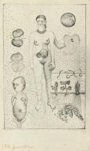 Frida And The Miscarriage by Frida Kahlo