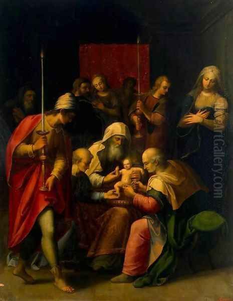 Circumcision - view 1