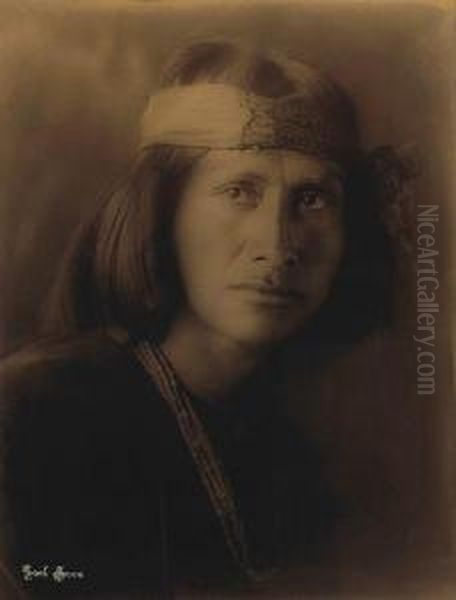 Cho-bah-begay (the Wolf), Navajo - view 1