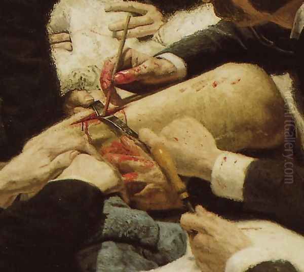 The Gross Clinic (detail) - view 1