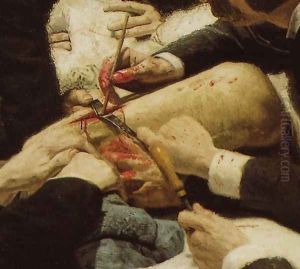 The Gross Clinic (detail) by Thomas Cowperthwait Eakins