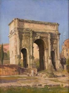 Arco Di Settimio Severo