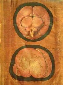 Anatomical drawing of the human brain by Hieronymus Fabricius ab Aquapendente