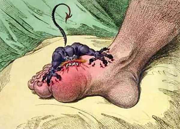The Gout - view 1