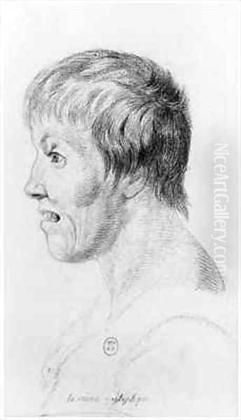 Epileptic woman profile - view 1