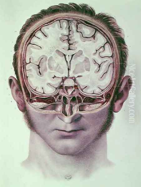 The Brain 2 - view 1