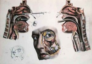 A Nasal Operation by Nicolas Henri Jacob