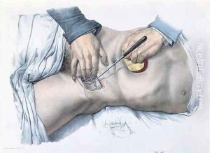 Tying up an artery by Nicolas Henri Jacob