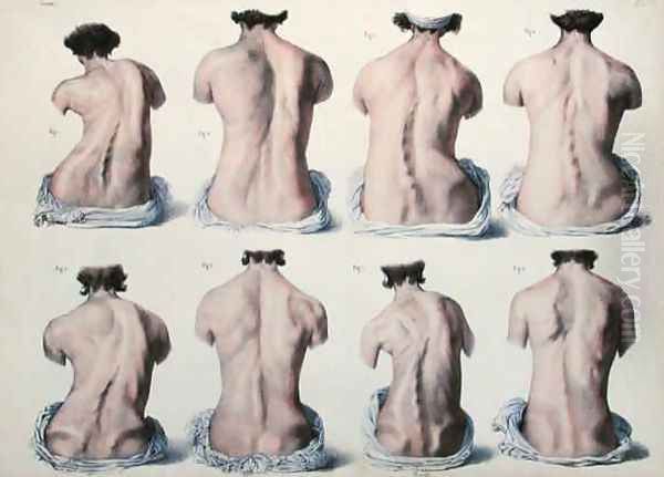 Spinal Deformities - view 1