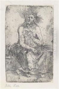 Der Schmerzensmannsitzend by Albrecht Durer