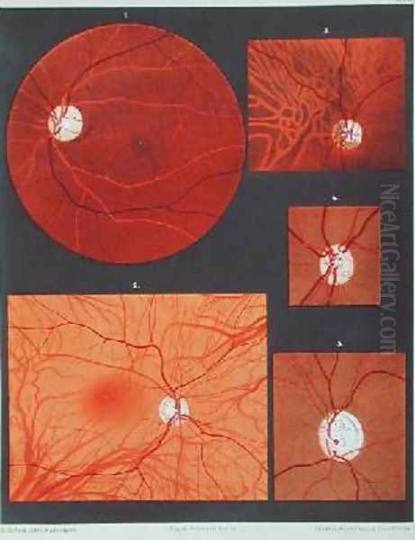 The eye seen through a microscope - view 1