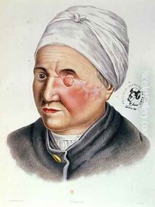 Illustration from Traite de Chirurgie Plastique by Lackerbauer