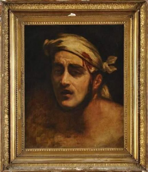 L'homme Blesse - view 1
