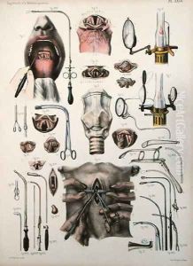 Tracheotomy operation, plate from Traite Complet de lAnatomie de lHomme by Jean-Baptiste Marc Bourgery 1797-1849 1866-67