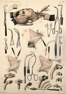 Tracheotomy operation, plate from Traite Complet de lAnatomie de lHomme by Jean-Baptiste Marc Bourgery 1797-1849 1866-67 2 by E. Pochet