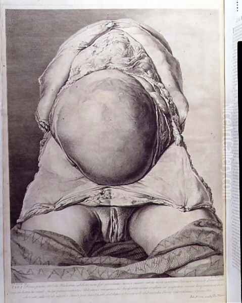 Anatomical drawing of the abdomen of a pregnant female human with skin peeled back, engraved by Francois Simon Ravenet 1706-74 pub. 1774 - view 1