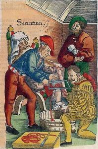 An Amputation, illustration from Feldtbuch der Wundartzney by Hans von Gersdorff, c.1540 by Hans or Johannes Ulrich Wechtlin
