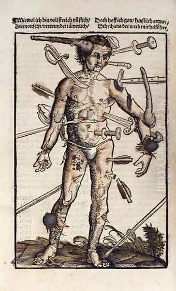 XVIIIv The Wound Man, from the Feldtbuch der Wundartzney by Hans von Gersdorff, 1517 - view 1