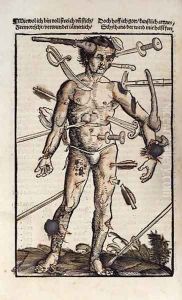 XVIIIv The Wound Man, from the Feldtbuch der Wundartzney by Hans von Gersdorff, 1517