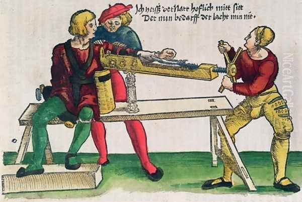 Apparatus for healing arm fractures, illustration from the Feldtbuch der Wundartzney by Hans von Gersdorff, c.1540 - view 1