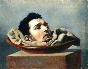 Guillotined head of a parricide executed at Puy in 1825
