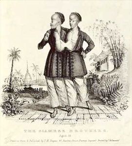 The Siamese Brothers, Aged 18 by Thomas Mann Baynes
