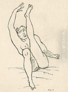 Hysterical epilepsy, attack, contortions 3 by Jean Francois Badoureau