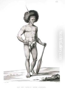 Papua Islands: Leprosy Victim, from 'Voyage Autour du Monde (1817-20)' by Jacques Etienne Victor Arago