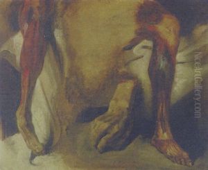 Asvered Hand And Two Ecorches Of A Leg by Eugene Delacroix