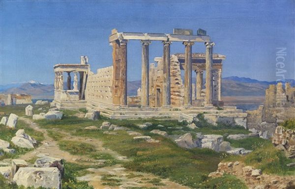 Der Erechtheion-tempel Auf Der Akropolis - view 1