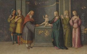 The Circumcision Of Christ