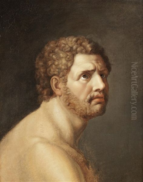 Achilles - view 1