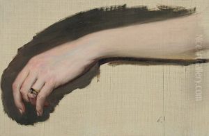 Unterarm Und Beringte Hand Einer Frau