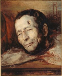 Tete de Giuseppe Fieschi (1790-1836), apres son execution by Jacques Raymond Brascassat