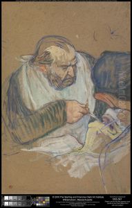 Dr. Pean Operating by Henri De Toulouse-Lautrec