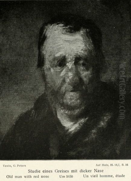 Study of a man with a swollen nose - view 1