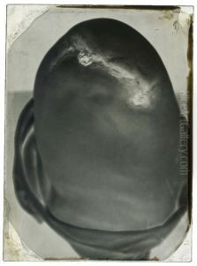 Moignon De Genou D'un Soldat De La Guerre by Alfred Dehodencq