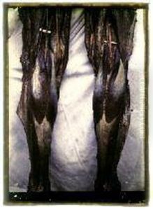 Jambes Ecorchees Paris by Maurice Letulle